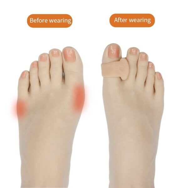 Orthotic Support for Little Toe and Thumb with Comfort Design SEBS Gel Hallux Valgus Splint