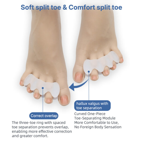 副图1 Preventing Rubbing Bunion Corrector Overlapping Hammer Toe Straightener Stretcher Soft Silicone Gel Toe Spacers for Bunions