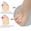 Pedicure Gel Silicone Hallux Valgus Corrector Double Hole Toe Separator