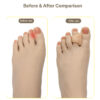 Hammer Toe Straightener Gel Toe Splints for Women/Men Corrector for Bent Curled Crooked Claw Hammer Toes