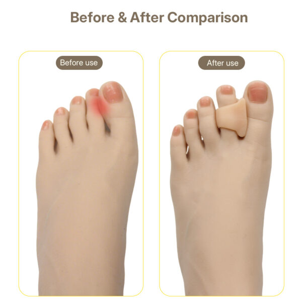 Hammer Toe Straightener Gel Toe Splints for Women/Men Corrector for Bent Curled Crooked Claw Hammer Toes