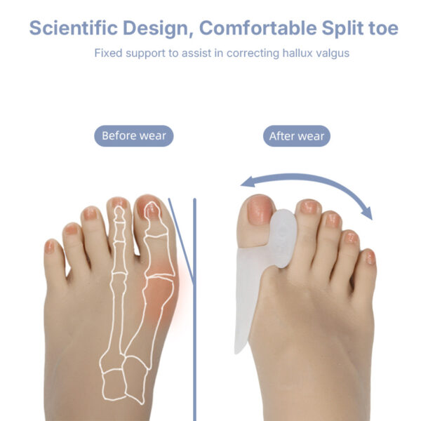 Foot Care Pain Relief Silicone Gel Hallux Valgus Corrector Big Toe Separator