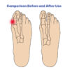 Elastic Tension Band Big Foot Bone Care Bunion Corrector Hallux Valgus Toe Separator